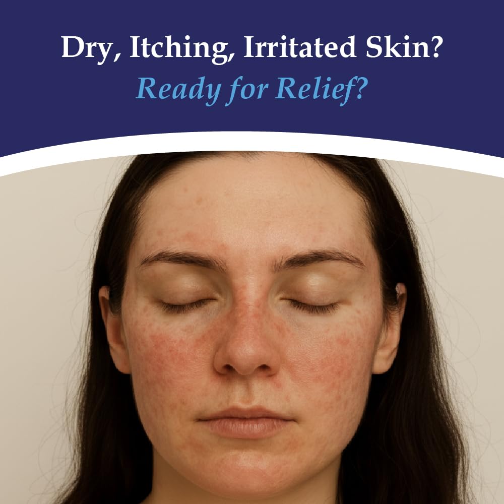 Noble Formula 2% Pyrithione Zinc (ZnP) Emu Oil Bar Soap, Especially Formulated for Acne, Psoriasis, and Eczema, Safe for Daily Use and All Skin Types, 3.25 oz